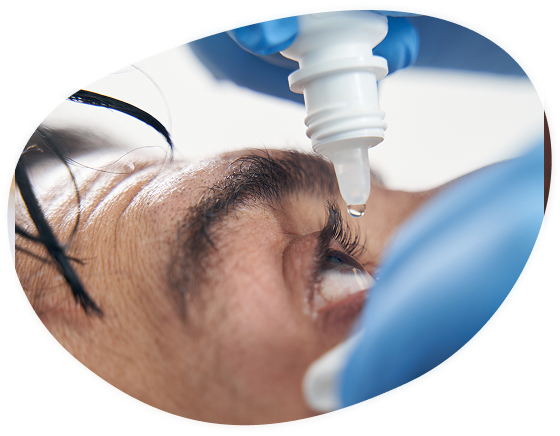 Dry Eye Treatment
